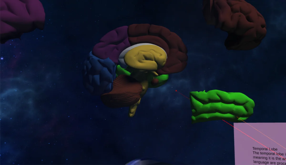 Brain Visualizer application